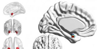Study: Looking inside the brain to distinguish bipolar from depression — (Details)