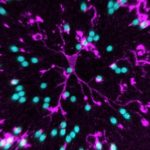 Study: The brain’s tiny thrill-seekers — (Details)