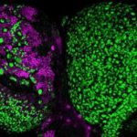 Study: The discovery of how a protein complex safeguards against certain brain tumors could inform future treatment strategies — (Details)