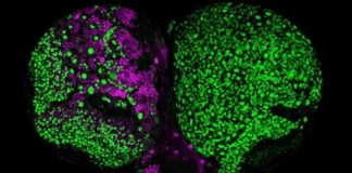 Study: The discovery of how a protein complex safeguards against certain brain tumors could inform future treatment strategies — (Details)
