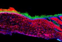 Research: Researchers turn open wounds into skin —