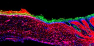 Research: Researchers turn open wounds into skin —