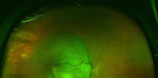 Study: Plant compound shuts down tumor growth — (Details)