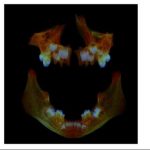 Study: What Anglo Saxon teeth can tell us about modern health — (Details)