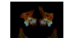 Study: What Anglo Saxon teeth can tell us about modern health — (Details)