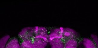 Study: Origin of incurable nervous disease lies in minute fibers formed by chains of the huntingtin protein — (Details)