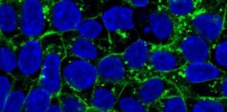 Study: Misaddressed proteins are mislocalized, with possibly fatal consequences for the cell — (Details)