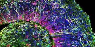 Study: Building a better brain-in-a-dish, faster and cheaper (Details)