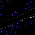 Study: Stem cell researchers and others outline a potential way to repair joint cartilage — (Details)