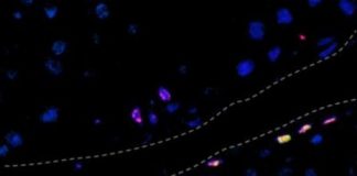 Study: Stem cell researchers and others outline a potential way to repair joint cartilage — (Details)