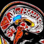 Study: ‘Mindful people’ feel less pain; MRI imaging pinpoints supporting brain activity — (Details)