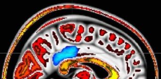 Study: ‘Mindful people’ feel less pain; MRI imaging pinpoints supporting brain activity — (Details)