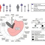 Study: Family genetics vital for understanding autism progression — (Details)