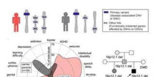 Study: Family genetics vital for understanding autism progression — (Details)