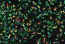 Research: New lab technique for separating infected and uninfected cells helps reveal how Zika virus manipulates the human immune system —