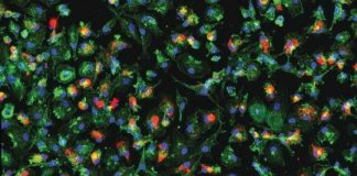 Research: New lab technique for separating infected and uninfected cells helps reveal how Zika virus manipulates the human immune system —