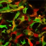 Study: Mononuclear phagocytes can both promote and inhibit inflammation — (Details)