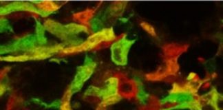 Study: Mononuclear phagocytes can both promote and inhibit inflammation — (Details)