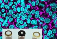 Tech: Carbon nanodots do an ultrafine job with in vitro lung tissue — (Report)