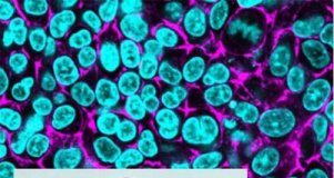 Tech: Carbon nanodots do an ultrafine job with in vitro lung tissue — (Report)