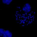 Study: Researchers develop approach to yield more complete picture of cancer — (Details)