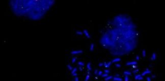 Study: Researchers develop approach to yield more complete picture of cancer — (Details)