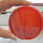 Study: New bacterial strain named after Cornish discovery — (Details)