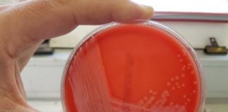 Study: New bacterial strain named after Cornish discovery — (Details)