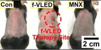 Tech: A wearable device for regrowing hair — (Report)