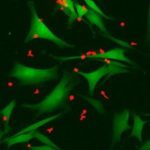 Study: A new approach to identifying ‘signposts’ on cancer cells may help immune cells eliminate the disease — (Details)