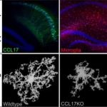 Study: It influences signal transmission in the brain — (Details)