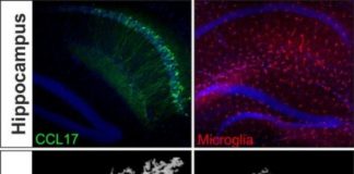 Study: It influences signal transmission in the brain — (Details)