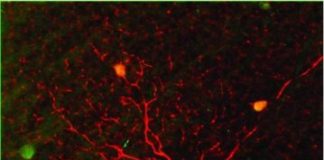 Study: Cells in retina change their duties to help the brain detect motion — (Details)