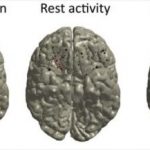 Study: After placing a bet, gamblers’ thought processes focus on regret about past bets — (Details)