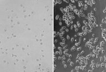 Research: Cancer drug and antidepressants provide clues for treating brain-eating amoeba infections —