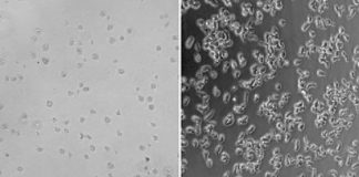 Research: Cancer drug and antidepressants provide clues for treating brain-eating amoeba infections —