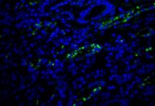 Research: Viruses under the microscope —