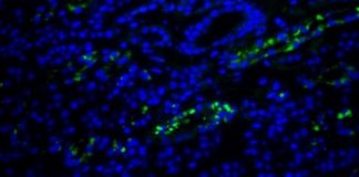 Research: Viruses under the microscope —