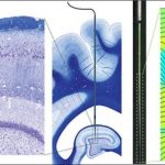 Study: Characterizing pig hippocampus could improve translational neuroscience — (Details)