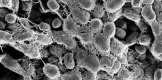 Study: Targeting this key bacterial molecule could reduce the need for antibiotics — (Details)