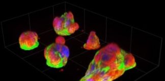 Study: New micro-platform reveals cancer cells’ natural behavior — (Details)