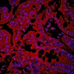 Study: Study points to possible way to predict increased inflammation risk — (Details)