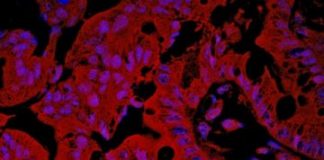 Study: Study points to possible way to predict increased inflammation risk — (Details)