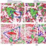 Study: Looking to immune cell shapes to predict how well body will fight lung cancers — (Details)
