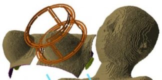 Study: Simulations of every woman’s breast tissue address delay on enhanced MRI cancer detection — (Details)