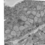 Study: Neural superhighway conveys messages from gut to brain in milliseconds — (Details)