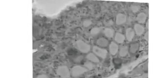 Study: Neural superhighway conveys messages from gut to brain in milliseconds — (Details)