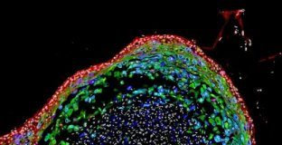 Research: Tiny organoids enable personalized disease diagnosis, regenerative therapies —