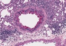 Research: Gut fungus exacerbates asthma in antibiotic-treated mice —