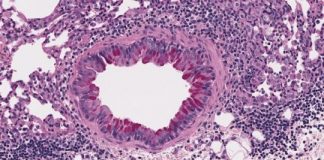 Research: Gut fungus exacerbates asthma in antibiotic-treated mice —